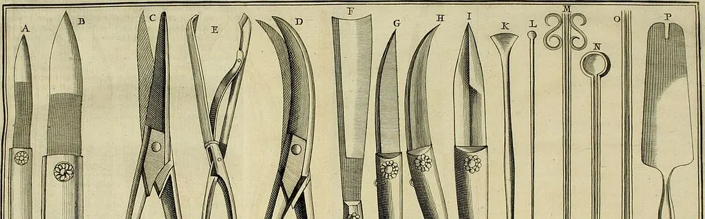 Face à la montée des Verts, les lobbys sortent les pincettes